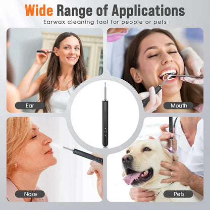 🔥SEAGRIL™ Pro Ear Cleaner Kit (HD Camera Ear Pick)-Live view • Soft silicone tips • USB-C rechargeable