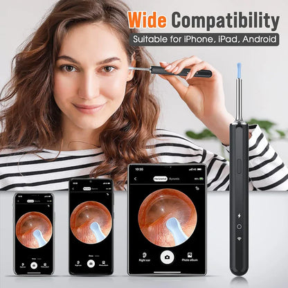 🔥SEAGRIL™ Pro Ear Cleaner Kit (HD Camera Ear Pick)-Live view • Soft silicone tips • USB-C rechargeable